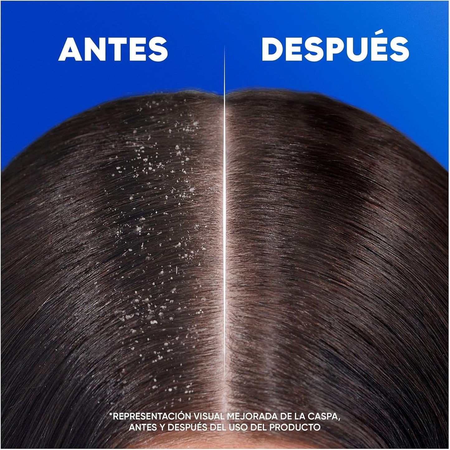 H&S Nutre y Cuida Champú Anticaspa para Uso Diario. Pack Ahorro 2 x 700 ml. Hasta 100% de Protección Anticaspa, Clínicamente Probado. Para Todo Tipo de Pelo y Cuero Cabelludo. Frescor y Limpieza