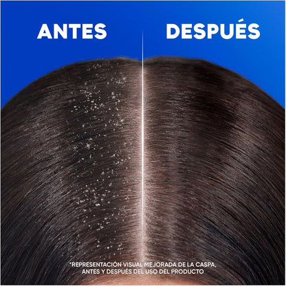 H&S Nutre y Cuida Champú Anticaspa para Uso Diario. Pack Ahorro 2 x 700 ml. Hasta 100% de Protección Anticaspa, Clínicamente Probado. Para Todo Tipo de Pelo y Cuero Cabelludo. Frescor y Limpieza